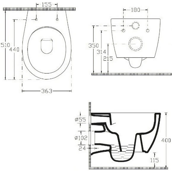 Унитаз биде Allen Brau Fantasy 4.11HC1.20 подвесной Белый без сиденья