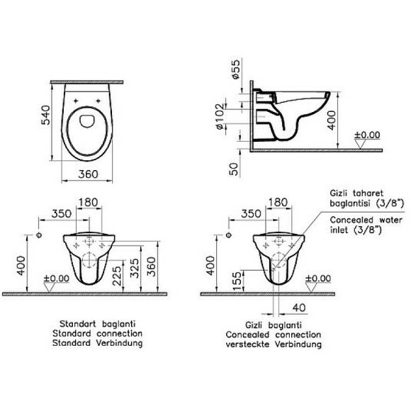 Комплект унитаза с инсталляцией Vitra Normus 9773B003-7202 с сиденьем Микролифт и клавишей смыва Хром глянцевый