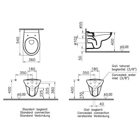 Комплект унитаза с инсталляцией Vitra Normus 9773B003-7203 с сиденьем Микролифт и клавишей смыва Хром матовый